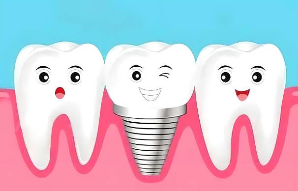 Dental implants in Macau: the perfect combination of innovative technology and quality care