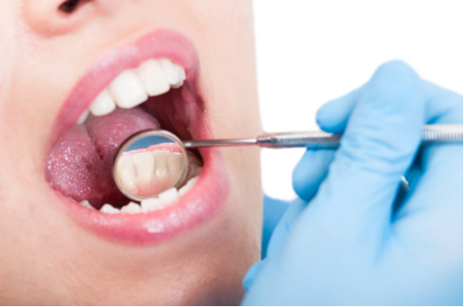 Vickong Dental Helps You Understand the Benefits of Professional Teeth Cleaning in Macau