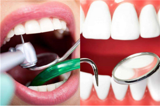 2024 Macau Teeth Cleaning Price, Why Choose to Go North to Zhuhai Teeth Cleaning