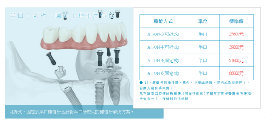 Macau all on 4 full mouth reconstruction costs