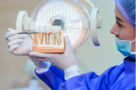 How much does dental implants cost in Macau? How much does dental implants cost in Zhuhai?